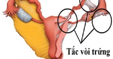 tac1522291919_7187